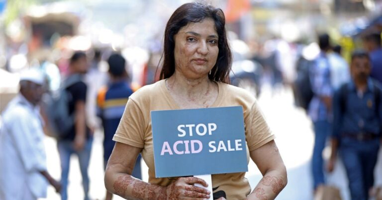 OTB Foundation a sostegno delle donne vittima di violenza con acido in India